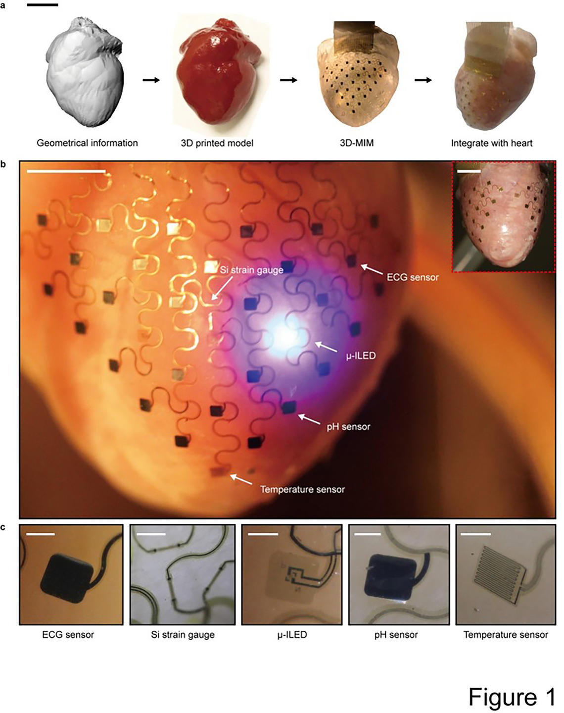 Igor Efimov is working on an implantable device that can measure various conditions in the heart, such as pH, and treat conditions by acting as a defibrillator, pacemaker and even a gene therapy delivery tool. 