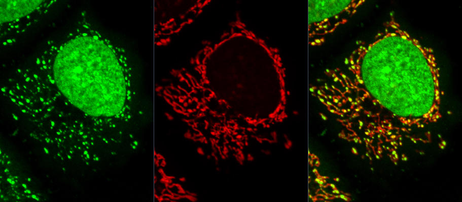 Fluorescence microscopy of a human epithelial cell showing mitochondria and DNA, labelled red and green, respectively.