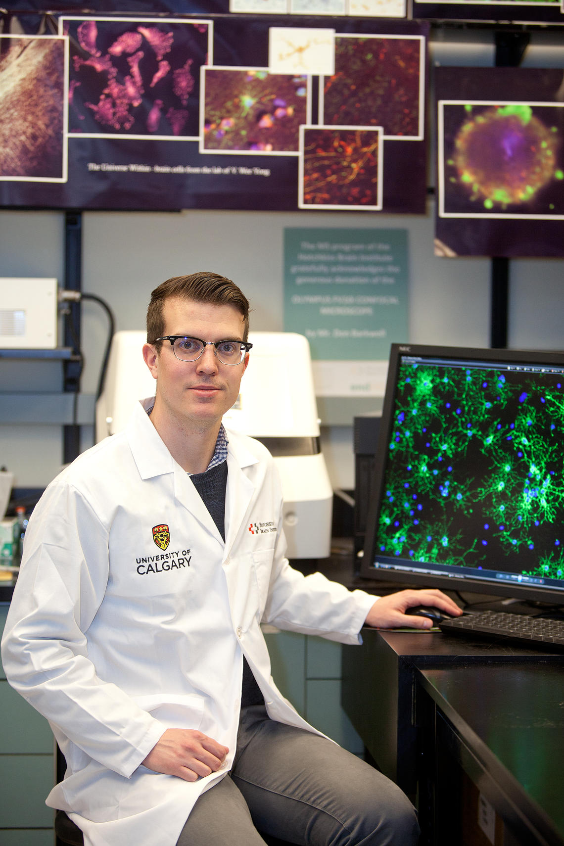 Michael Keough is a joint MD-PhD student in the Leaders in Medicine program at the Cumming School of Medicine and HBI trainee. Searching for better therapies for patients with multiple sclerosis, Keough collaborated with the university's chemistry department, which created a chemical compound that he could test, to investigate the regeneration of myelin.