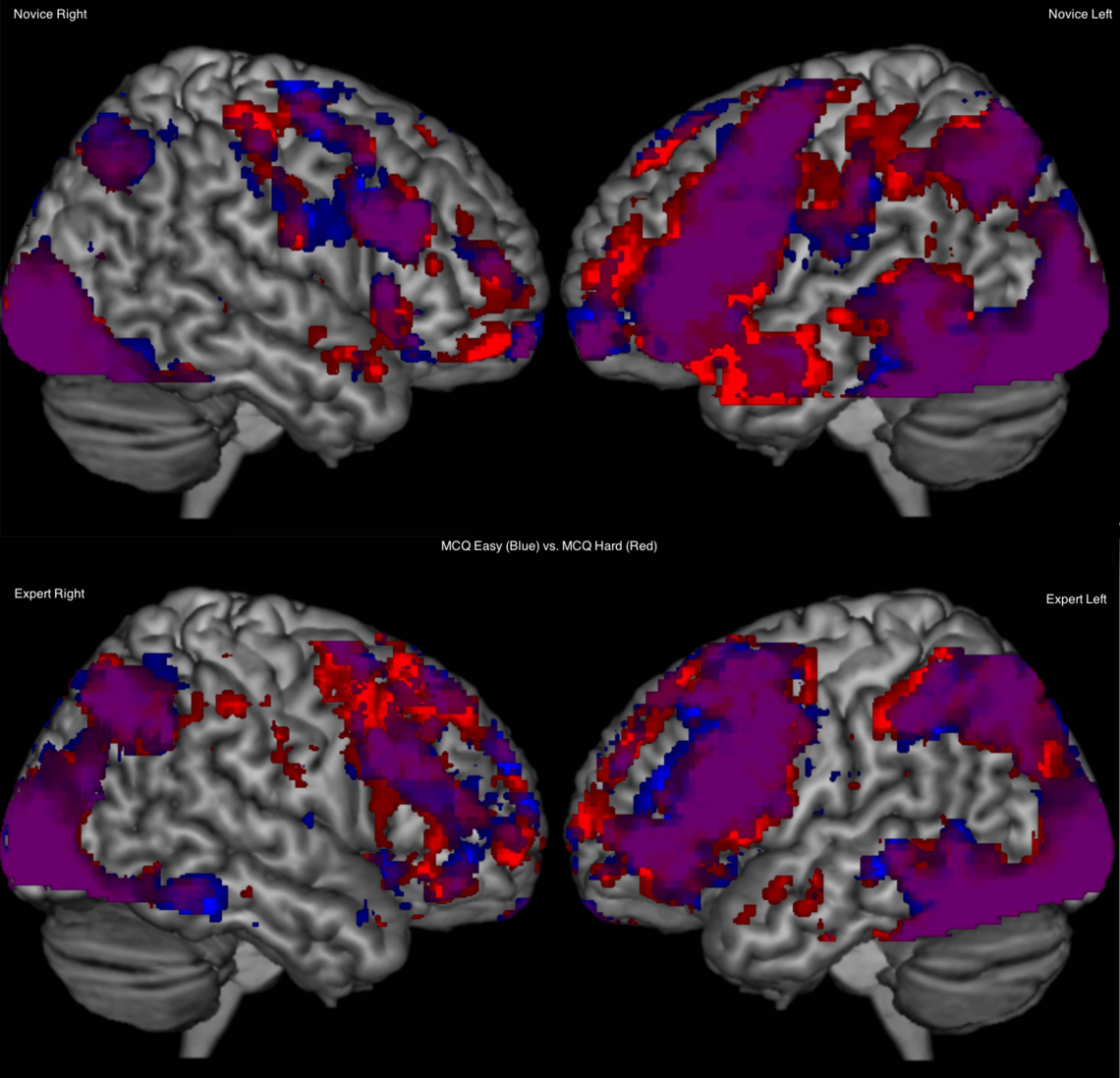 Brain Imaging Helps Researchers See How Physicians Make Decisions ...