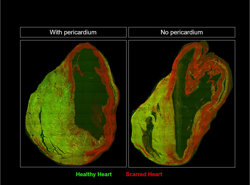 These are photos of the hearts from two mice, one month after a heart event. 