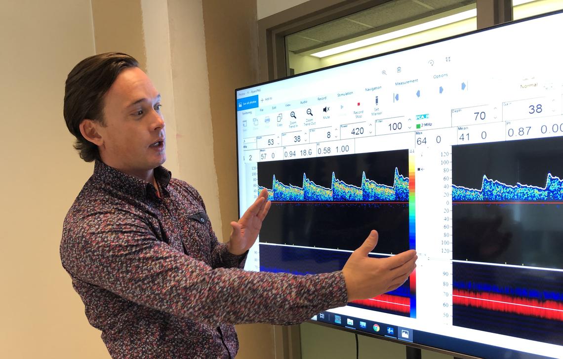 Aaron Phillips stands in front of a graph which shows how monitoring cerebral blood flow can test if enough blood is getting to the brain.