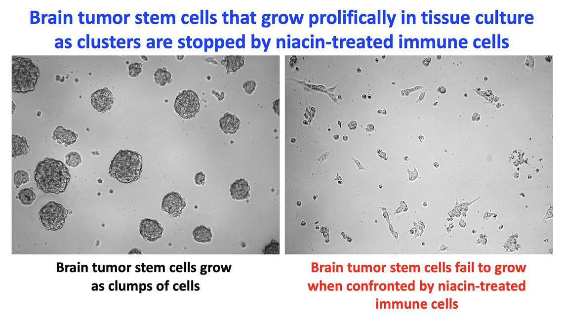 Slide showing brain tumour stem cells fail to grow when confronted with niacin-treated immune cells