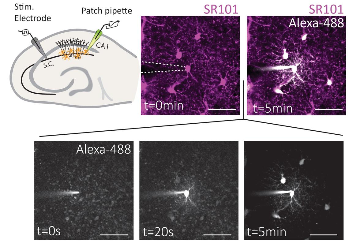 Images captured by a highly specialized imaging process called two-photon fluorescence show that stress reduces the movement of energy molecules through the astrocyte network. 