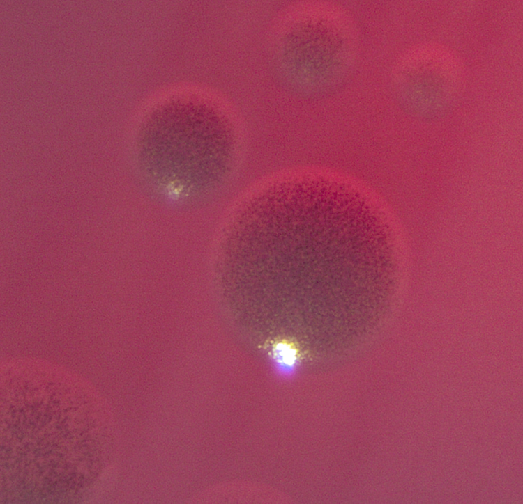 Porphyromonas asaccharolytica colonies on blood agar