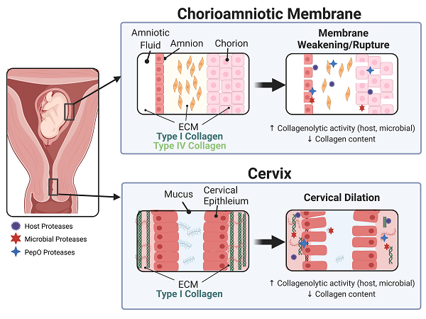 Chorioamniotic Membrane