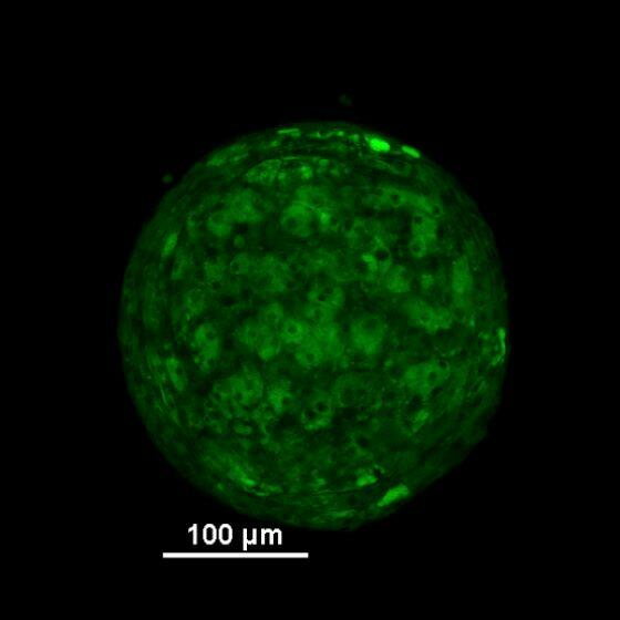 Image of a 3D spheroid that was generated by stem cells isolated from fat tissue and stimulated to differentiate into fat cells. 