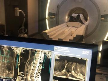 Magnetic Resonance Imaging shows the stimulator’s positioning in the body.