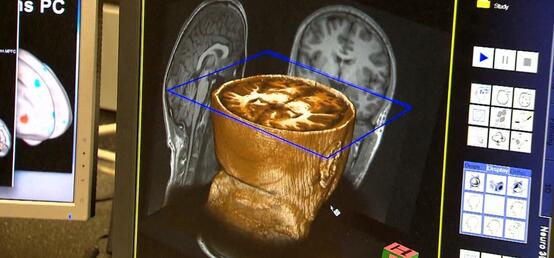 Researchers from Alberta universities patent urine-based analysis to diagnose concussions